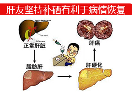 肝友堅持補硒有利于病情恢復