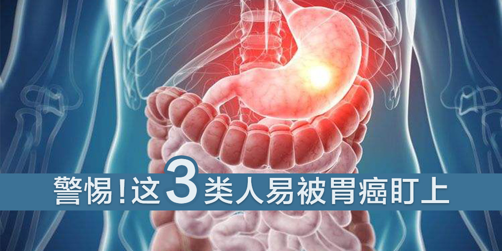 這3類人易被胃癌盯上，及時補硒是關(guān)鍵