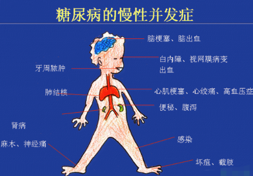 你還在害怕糖尿病嗎？科學(xué)補硒不“恐糖”