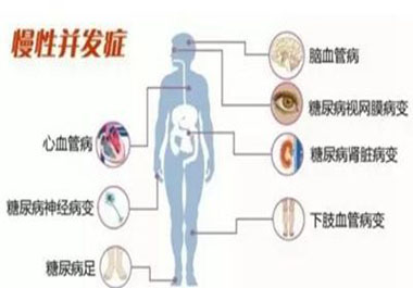 遠離高血糖并發(fā)癥，請記住一點，學(xué)會“補硒”